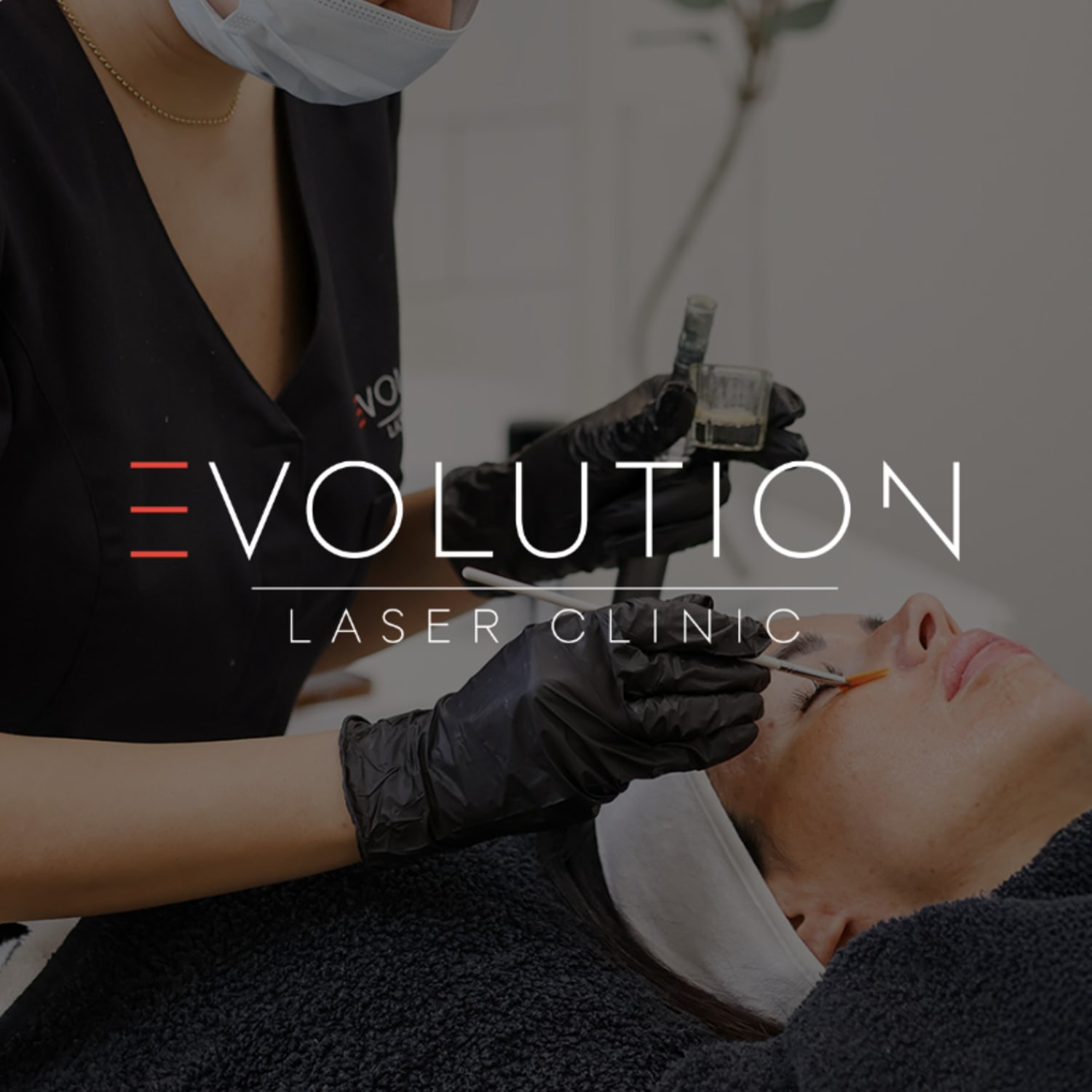 800 kr rabatt på kemisk peeling