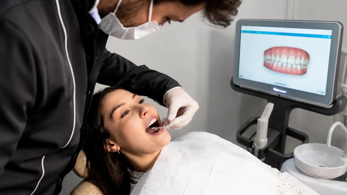 lear aligners treatment for teeth straightening