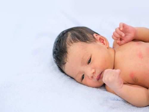 Memilih Pakaian Bayi yang Aman dari Gigitan Nyamuk Penyebab DBD