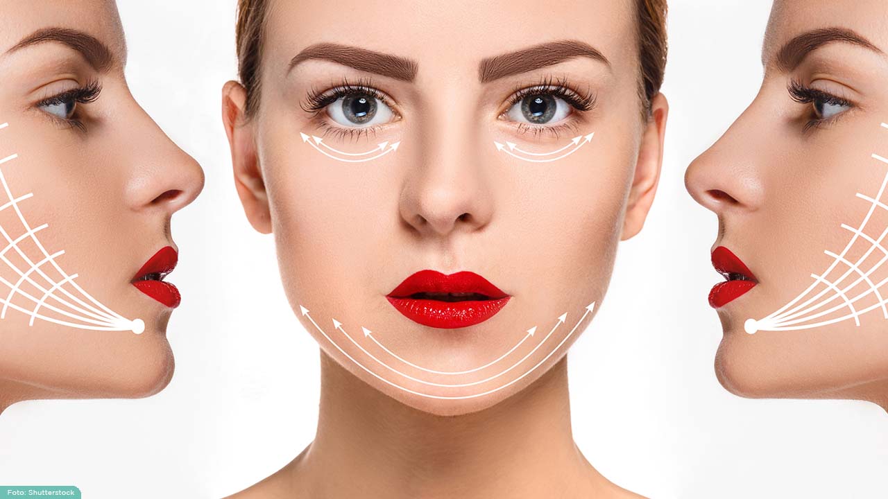 Treatment Tanam Benang Bikin Wajah Kencang Tanpa Operasi