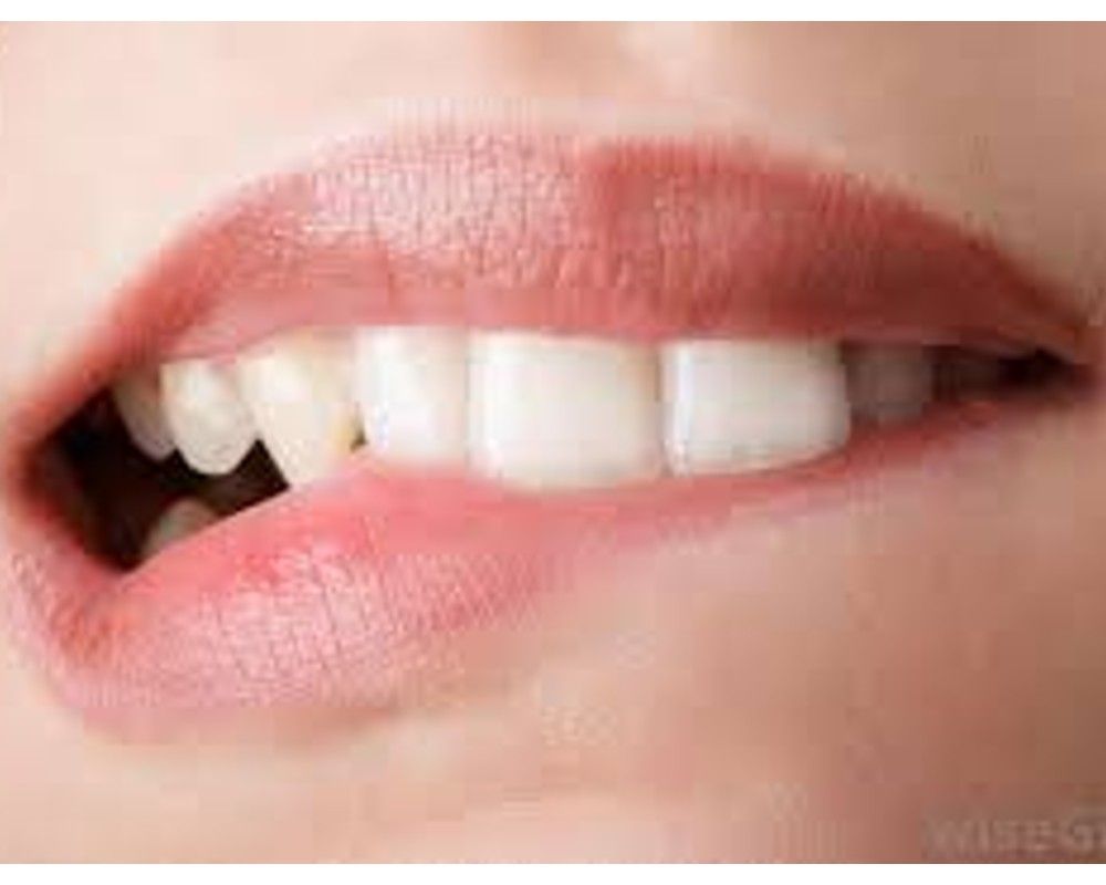 8 Cara Merawat Bibir Agar Tetap Lembab dan Merah Alami