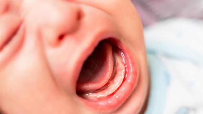 Bahaya Sering Bernapas Lewat Mulut Pada Anak