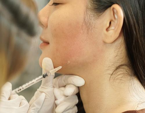 Tips Menghilangkan Double Chin yang Sering Dikeluhkan