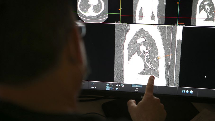 Cancers professionnels : une enquête pointe la sous-évaluation massive du risque au travail