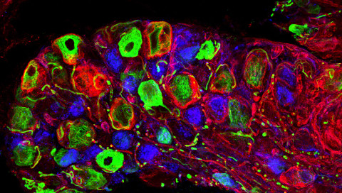 Sehen, was in Mäusehirnen passiert: Fluoreszierende Farbstoffe bringen Nervenstränge zum Leuchten