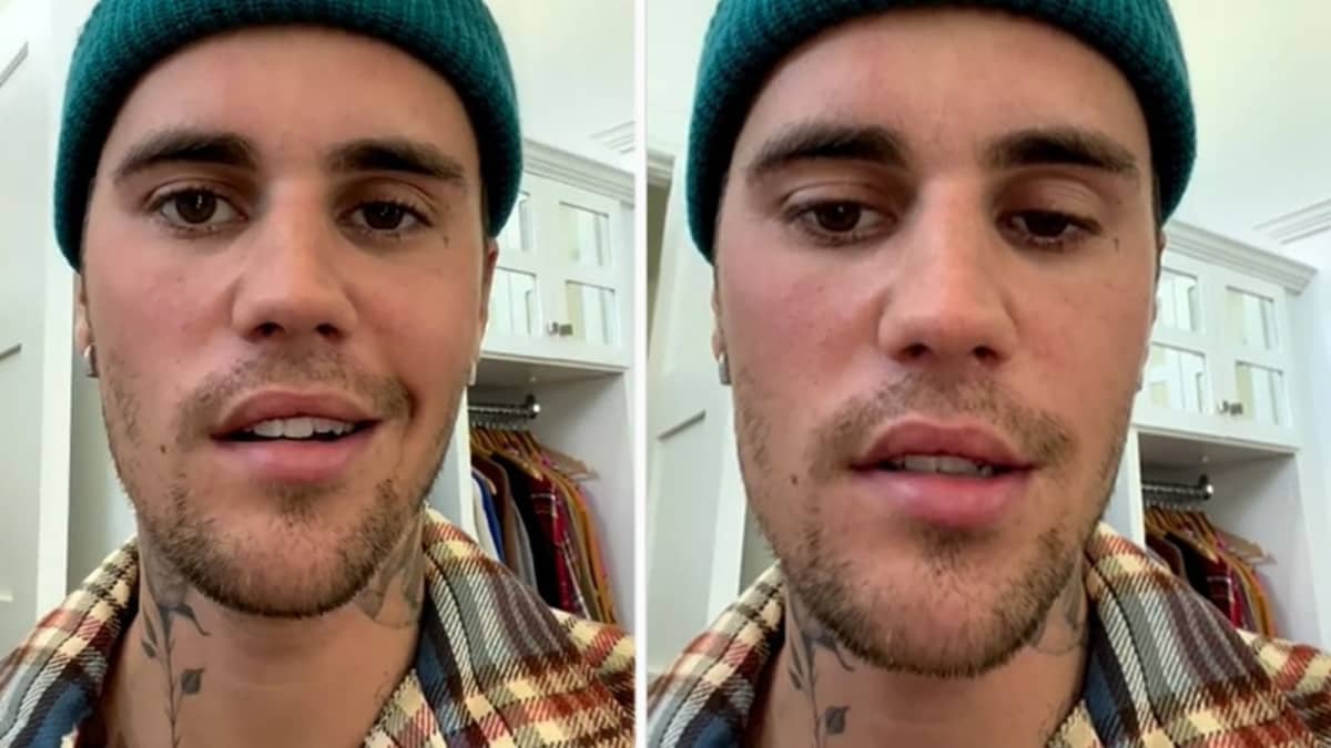 Ramsay Hunt syndrome the story behind Justin Bieber’s face paralysis Woo
