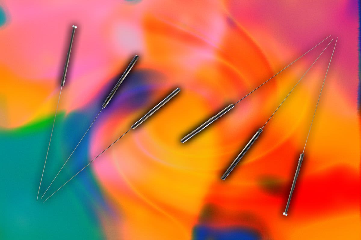 Woo reviews acupuncture Woo