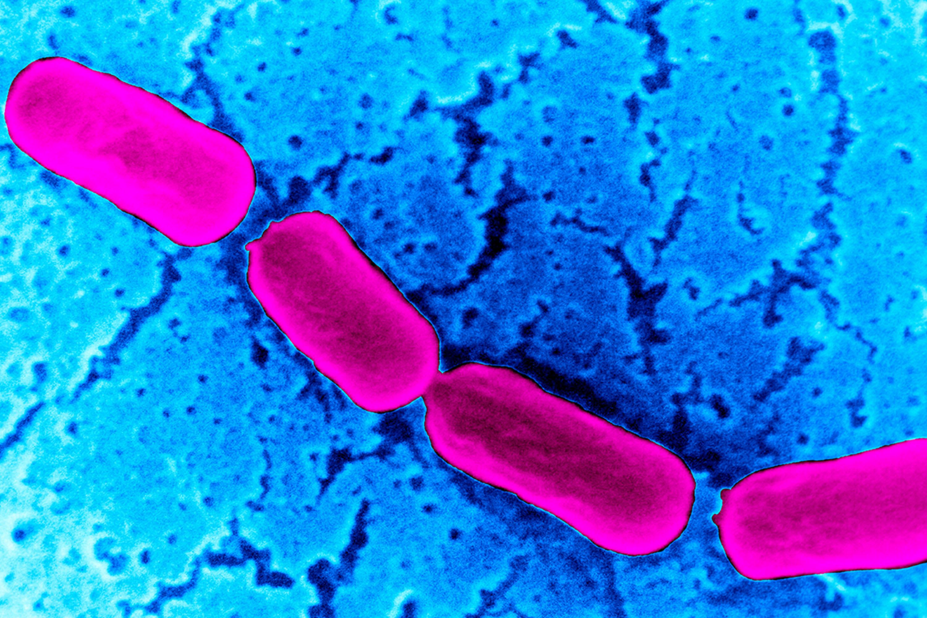 Could a robotic pill be the answer to managing our gut health?