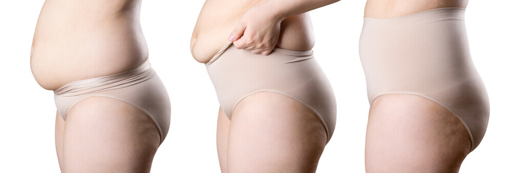 which shapewear is the best for slimming