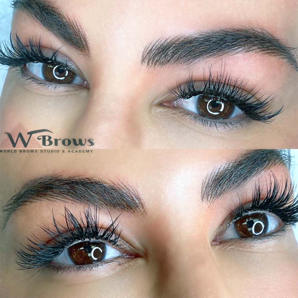 nano-hairstroke-with-ombre-combo-patient-ph16 Eyebrows Nano Hair Stroke or Nanoblading - World Brows Studio & Academy