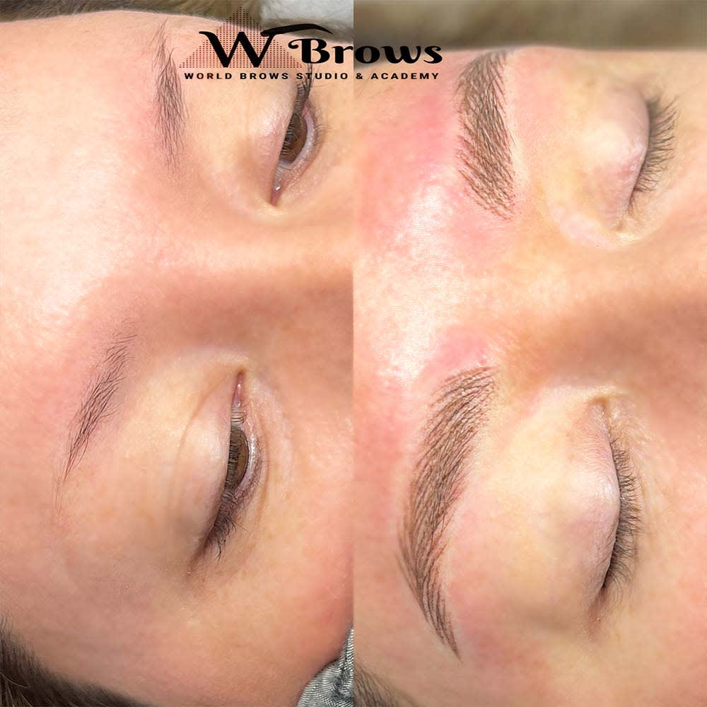 nano-hairstroke-with-ombre-combo-patient-ph9 Eyebrows Nano Hair Stroke or Nanoblading - World Brows Studio & Academy
