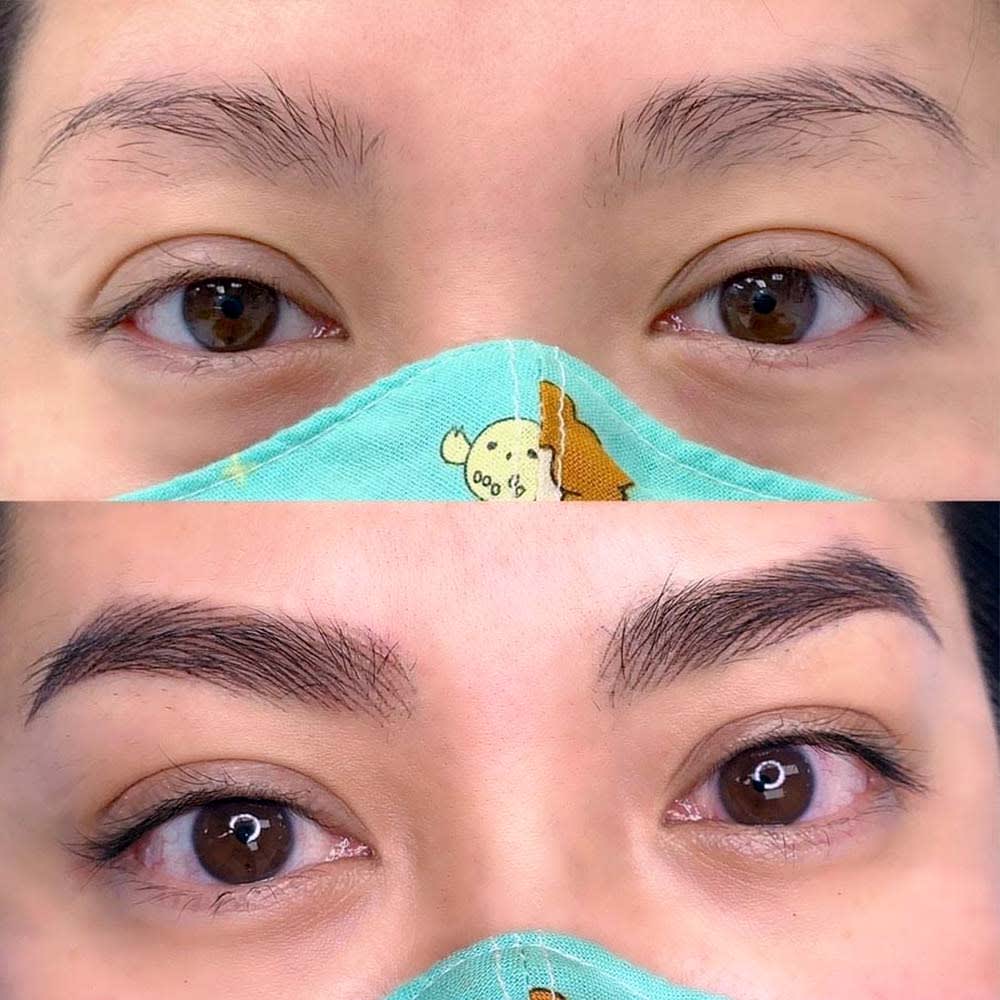 nano-hairstroke-with-ombre-combo-patient-ph21 Eyebrows Nano Hair Stroke or Nanoblading - World Brows Studio & Academy