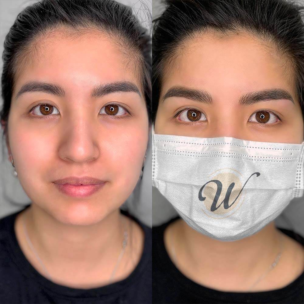 nano-hairstroke-with-ombre-combo-patient-ph3 Eyebrows Nano Hair Stroke or Nanoblading - World Brows Studio & Academy