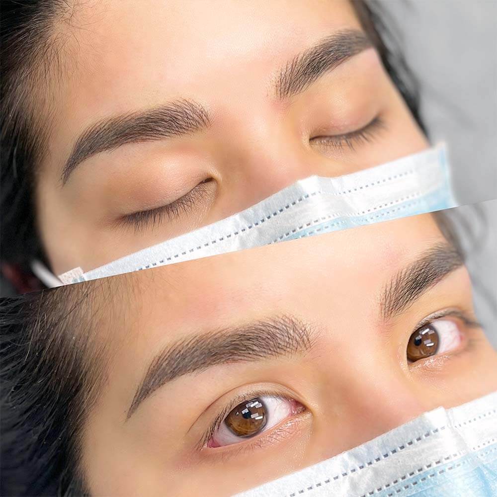 nano-hairstroke-with-ombre-combo-patient-ph2 Eyebrows Nano Hair Stroke or Nanoblading - World Brows Studio & Academy