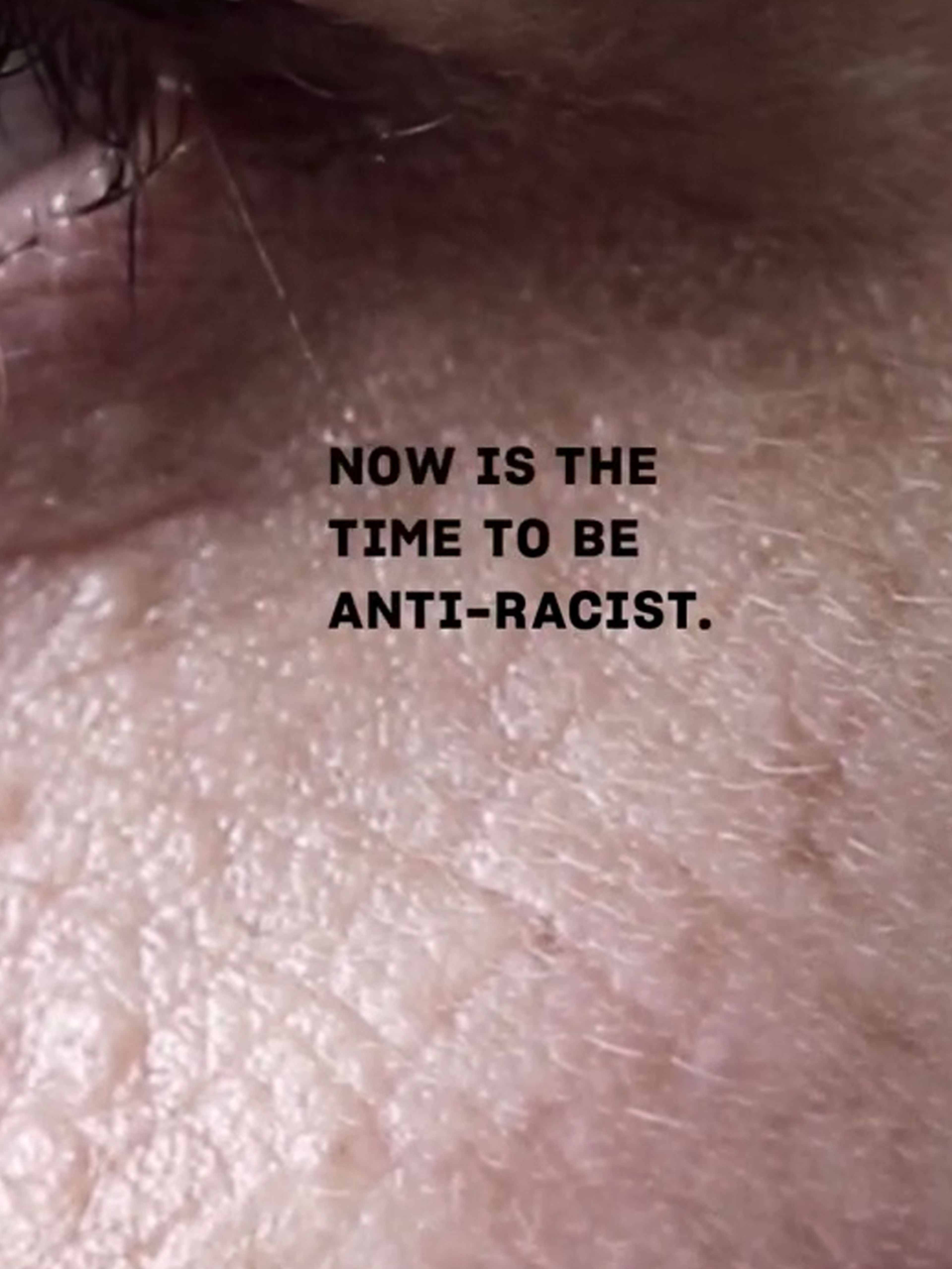 Image of white man's face with words "Now is the time to be anti-racist"