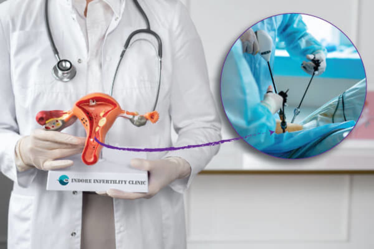 Laparoscopy for Diagnosis of Infertility