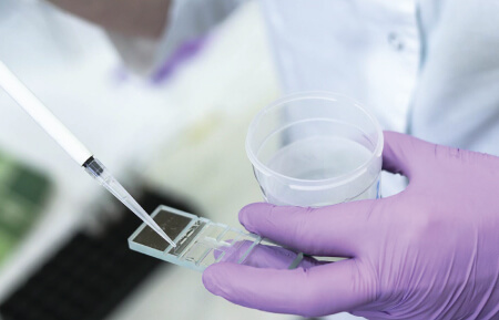 Advanced Semen Analysis