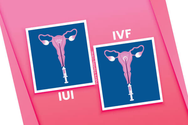 Both IUI and IVF are methods of fertilization, however to understand the difference between IUI and IVF please read the complete blog.