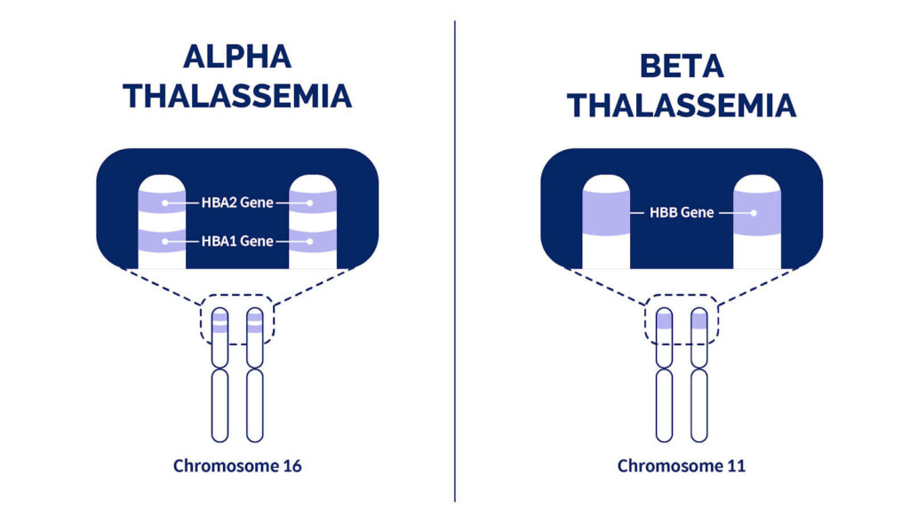 ThalassemiaAorB