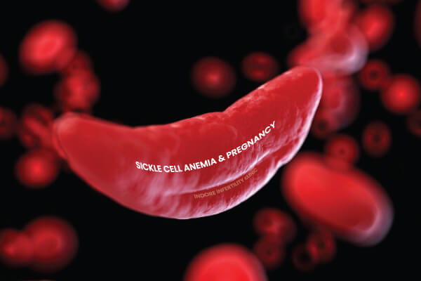 Sickle-Cell Anaemia, Fertility & Pregnancy