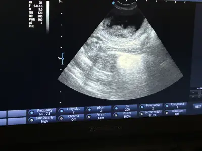 Wasserhund der Romagna - Abavár