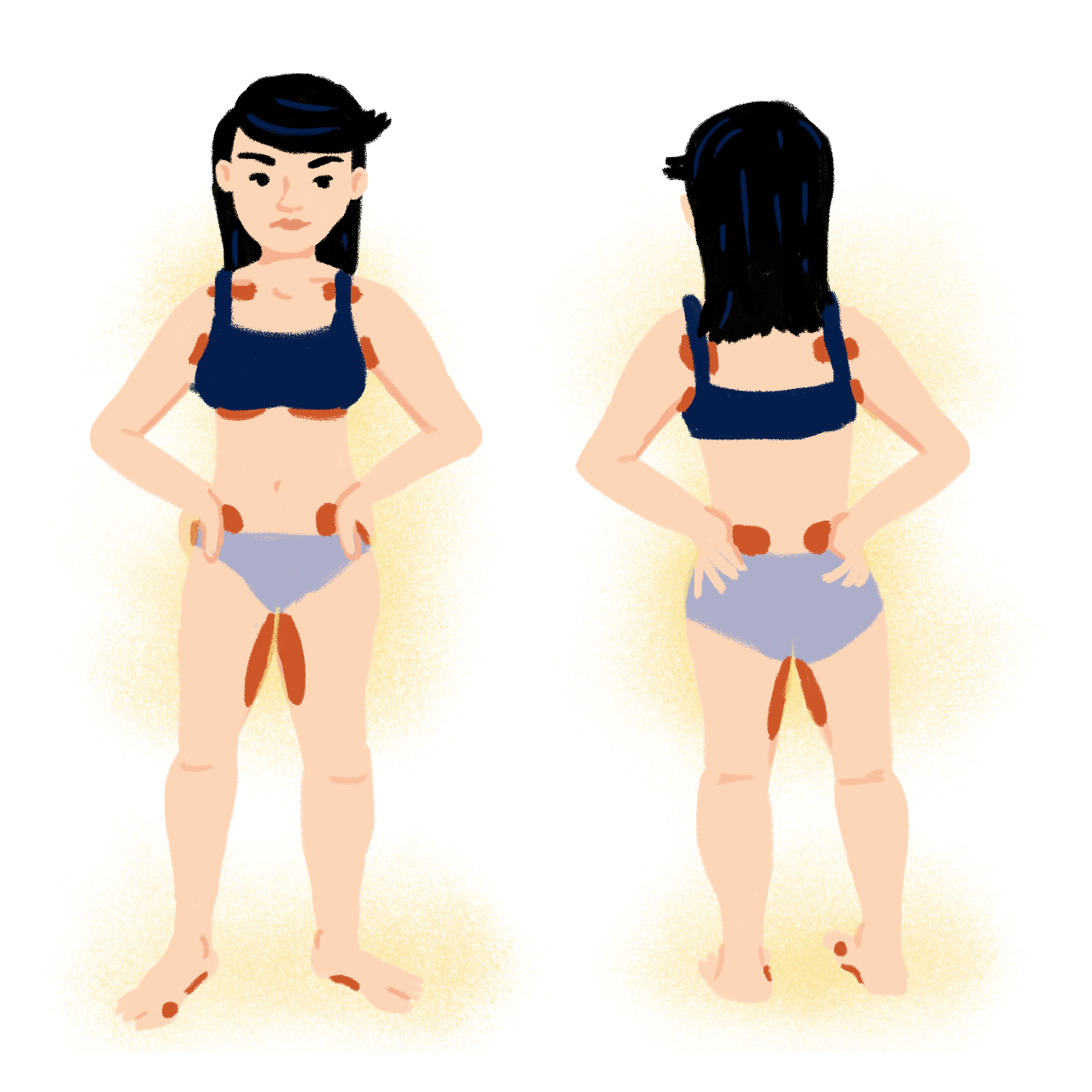 Chafing hotspots Chafing hotspots