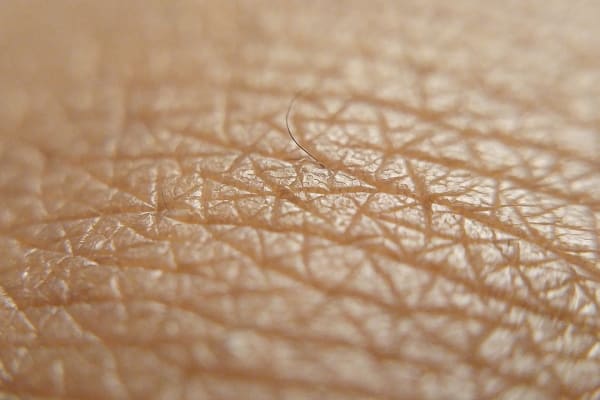 Human skin