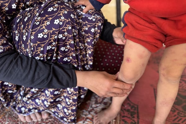 Dodelijke ziekten razen door Gaza