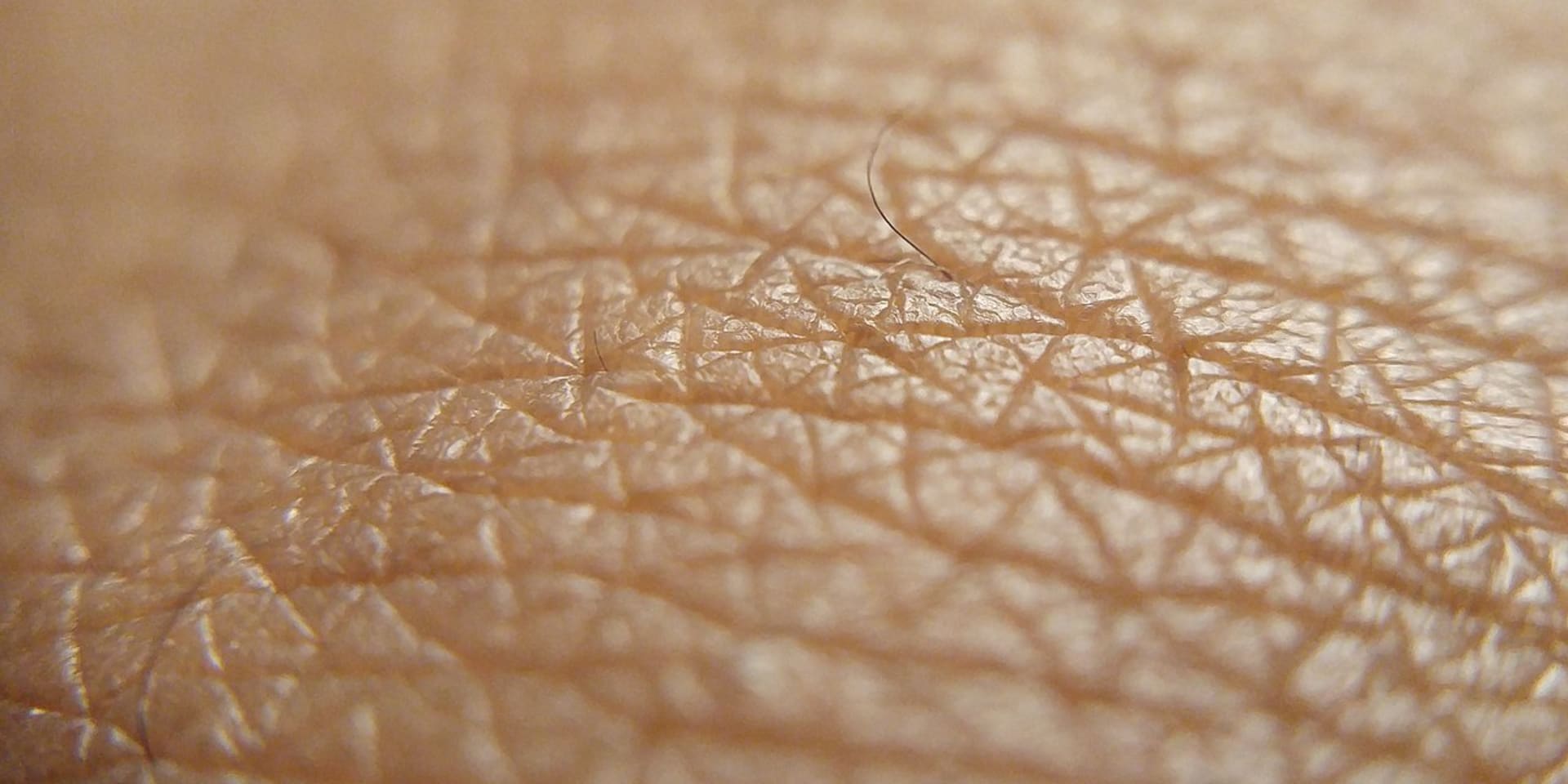 Human skin