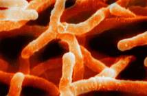 Chitinolytic actinomycetes with plant growth potential