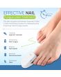 best nail laser treatment best nail laser treatment