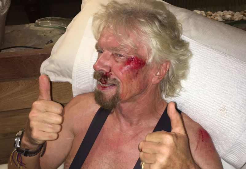 Richard Branson bike crash injury thumbs up