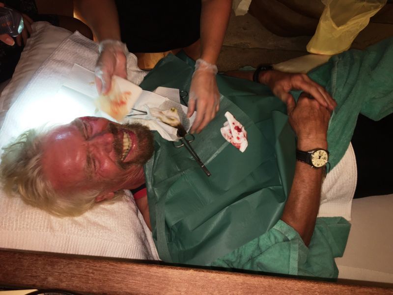 Richard Branson bike crash injury stitches