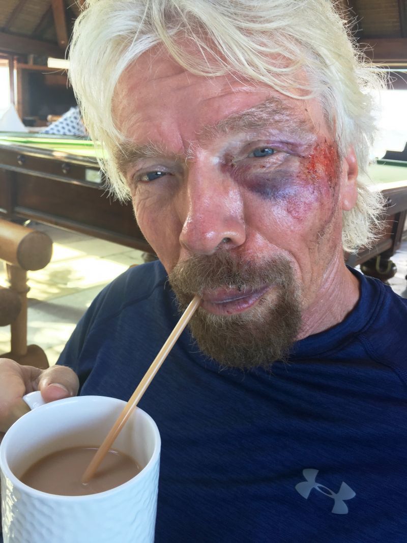 Richard Branson bike crash injury tea