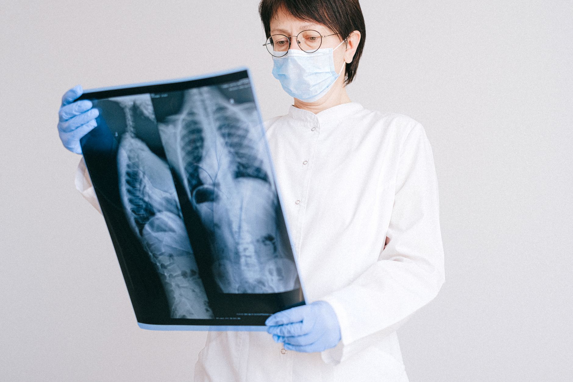 X-ray scan detects post-surgery heart issue in seven seconds