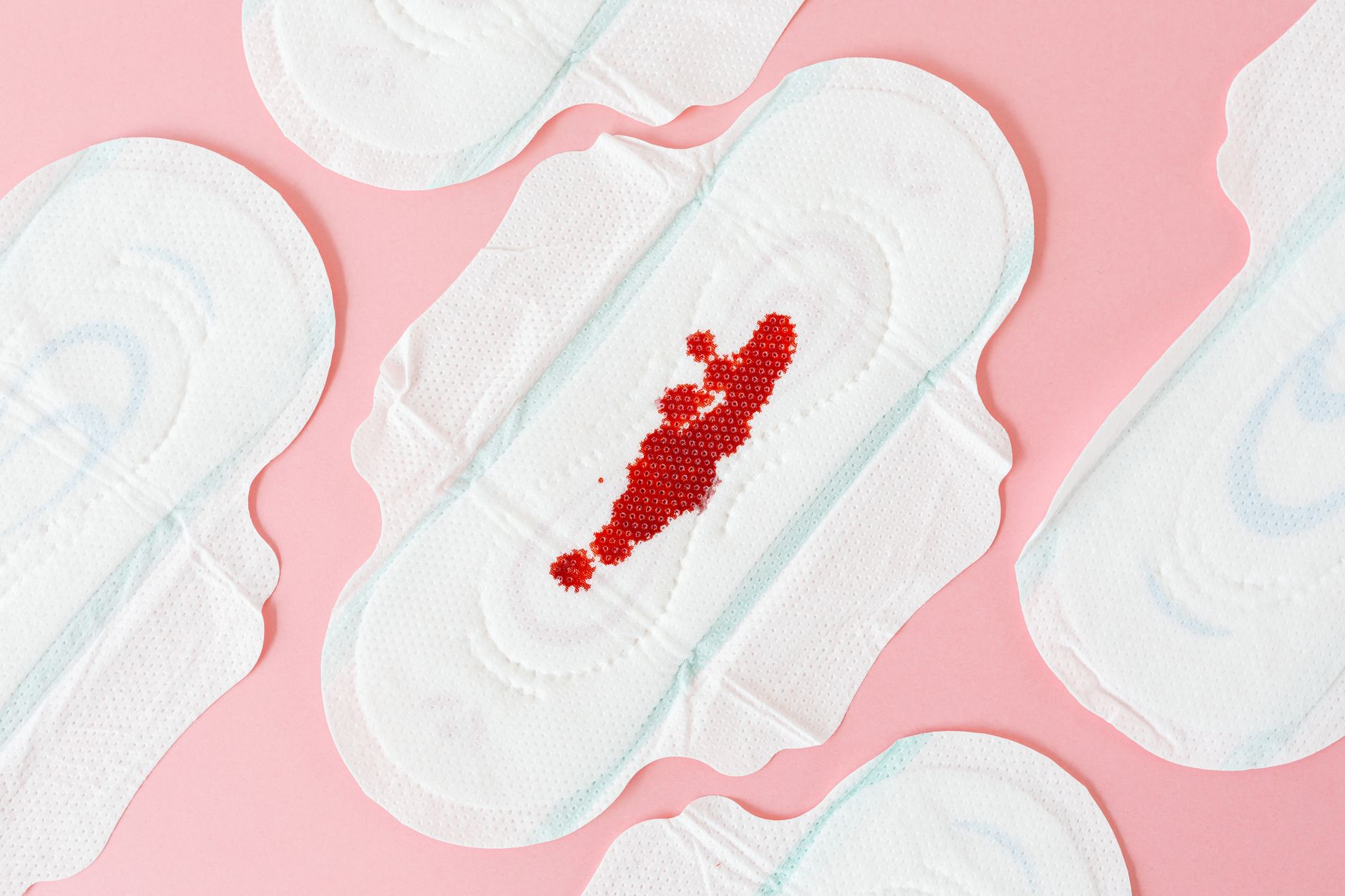 Do Ovarian Cysts Cause Irregular Periods Or Spotting?