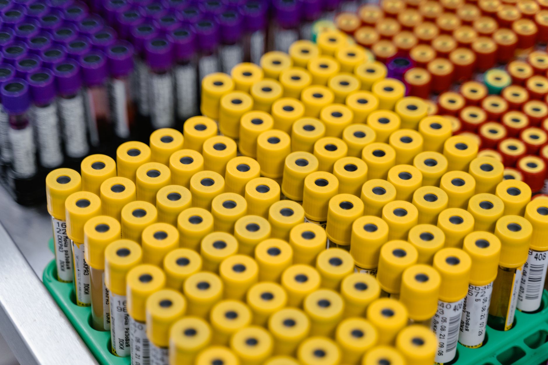 The Role of Serological Centrifuges in Clinical Diagnostics