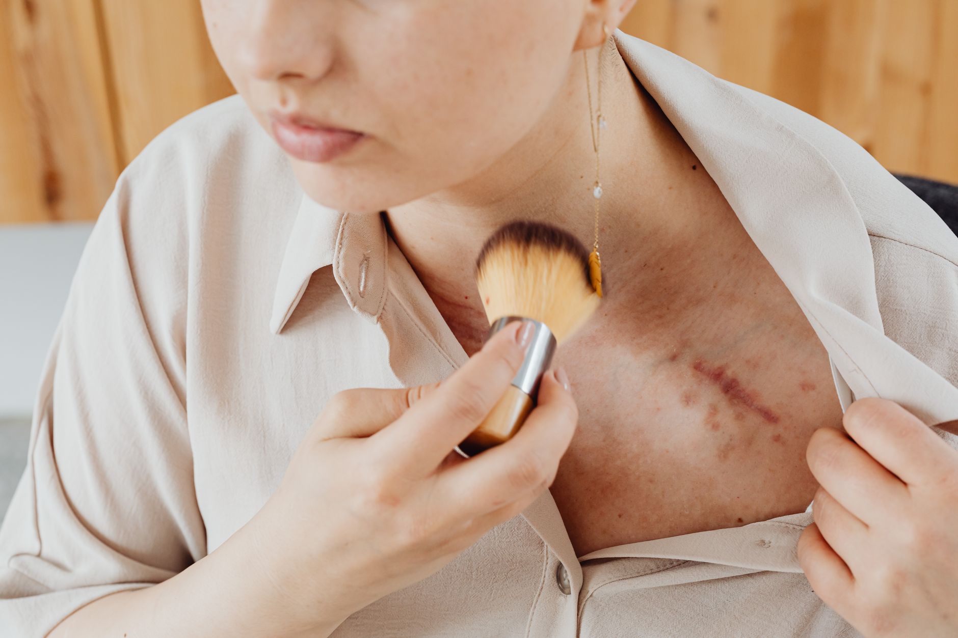 5 Reasons Why Scar Revision Is Worth A Deal