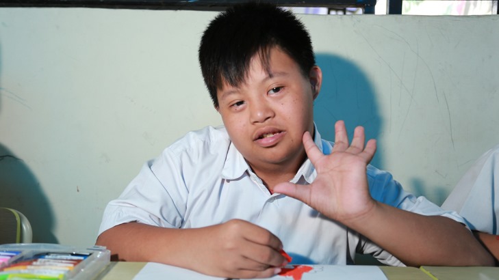 Alasan di Balik Kemiripan Wajah pada Orang dengan Down Syndrome