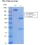 Image thumbnail for Anti-Estradiol immuno complex [C6] recombinant antibody