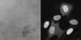 Image thumbnail for Cyclin A2-Venus Reporter Cell Line [RPE1 cycA2-venus/+ KI clone D6]