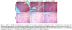 Image thumbnail for Tin Tungstate Nanoparticles β-SnWO4 small molecule (tool compound)