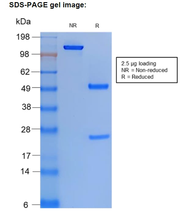 Image thumbnail for Anti-Estradiol immuno complex [C6] recombinant antibody