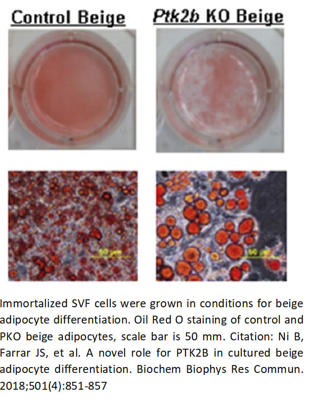 Image thumbnail for Mouse Inguinal Adipose SVF Preadipocyte Cell Line