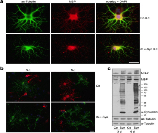 Image thumbnail for Anti-Myelin Basic Protein (region 82-87) [MBP12]