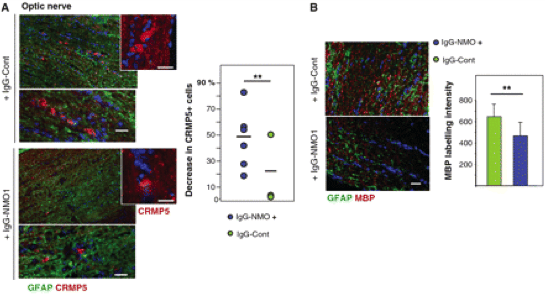 Image thumbnail for Anti-Myelin Basic Protein (region 129-138) [MBP1]