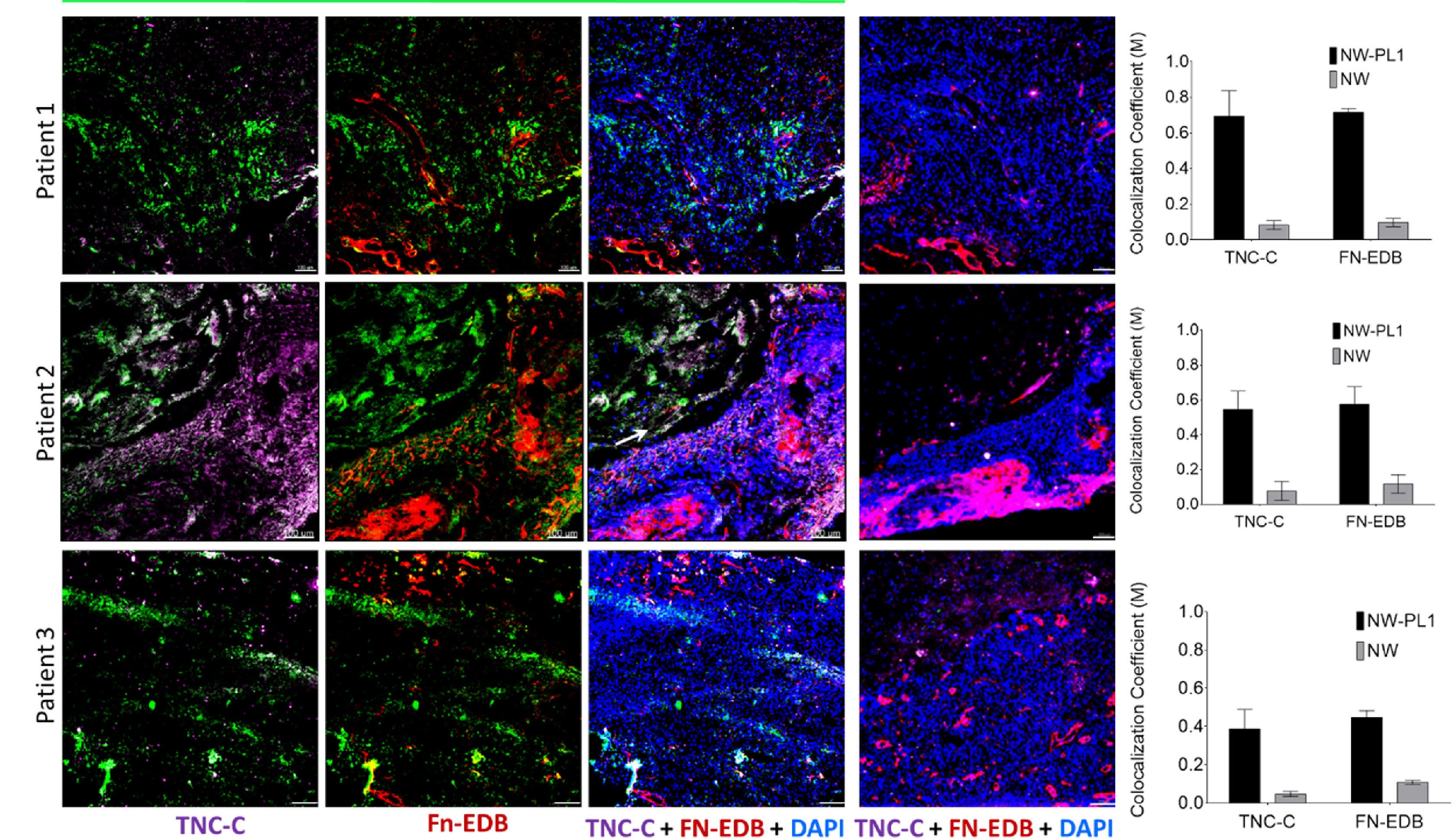 Image thumbnail for Anti-TNC-C [3F10.1] monoclonal antibody