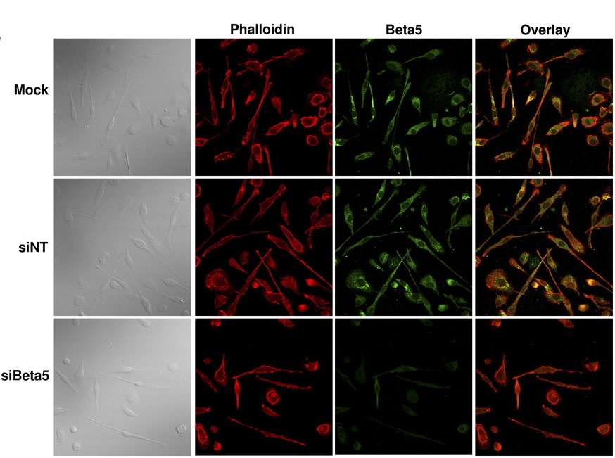 Image thumbnail for Anti-Integrin b3 [MHF4]