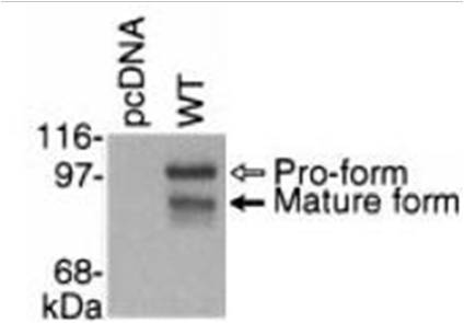 Image thumbnail for Anti-ADAM28, Polyclonal [28MOCYT]