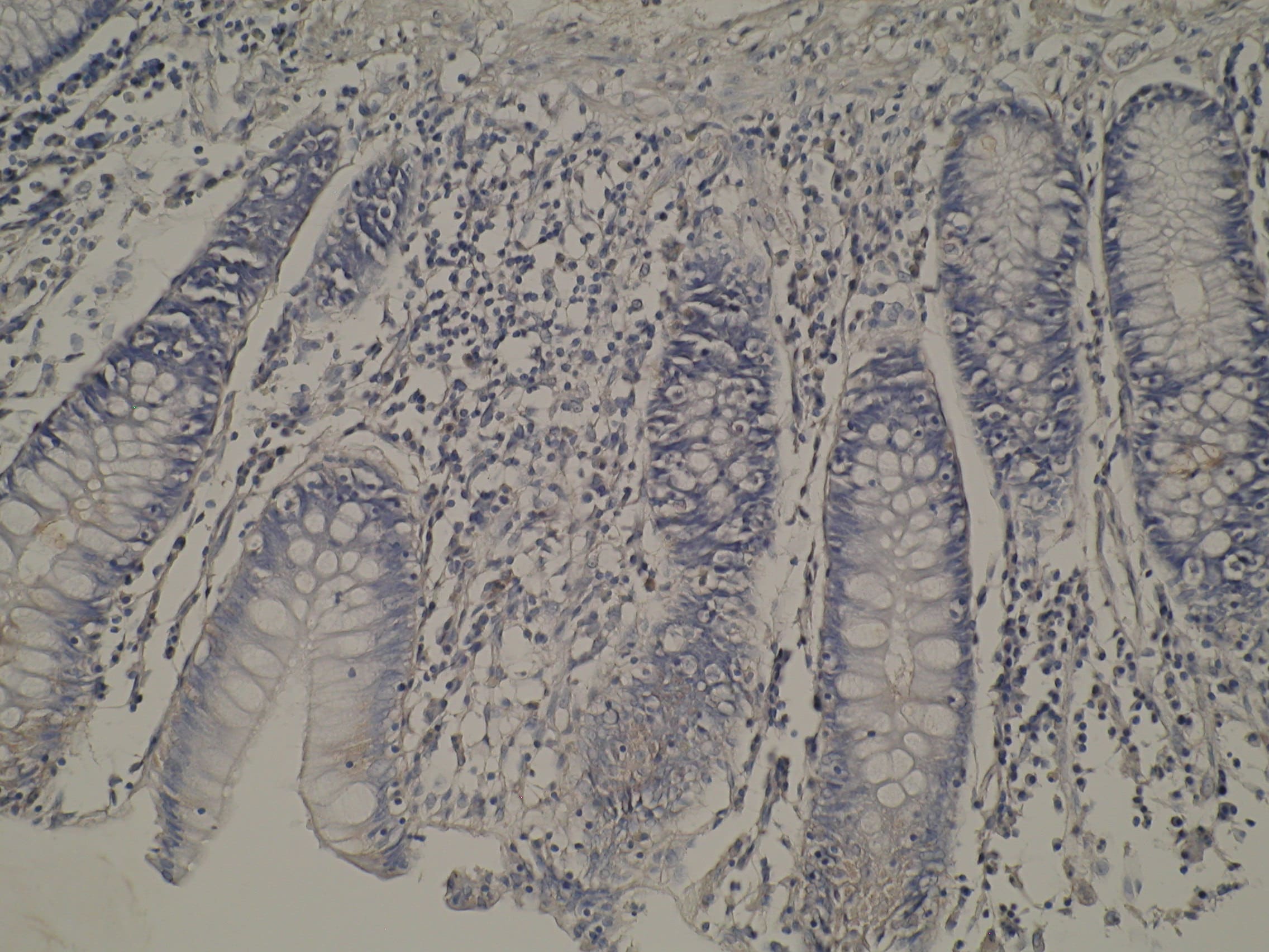 Image thumbnail for Anti-Cytochrome P450 8B1 [M15-P3B7]